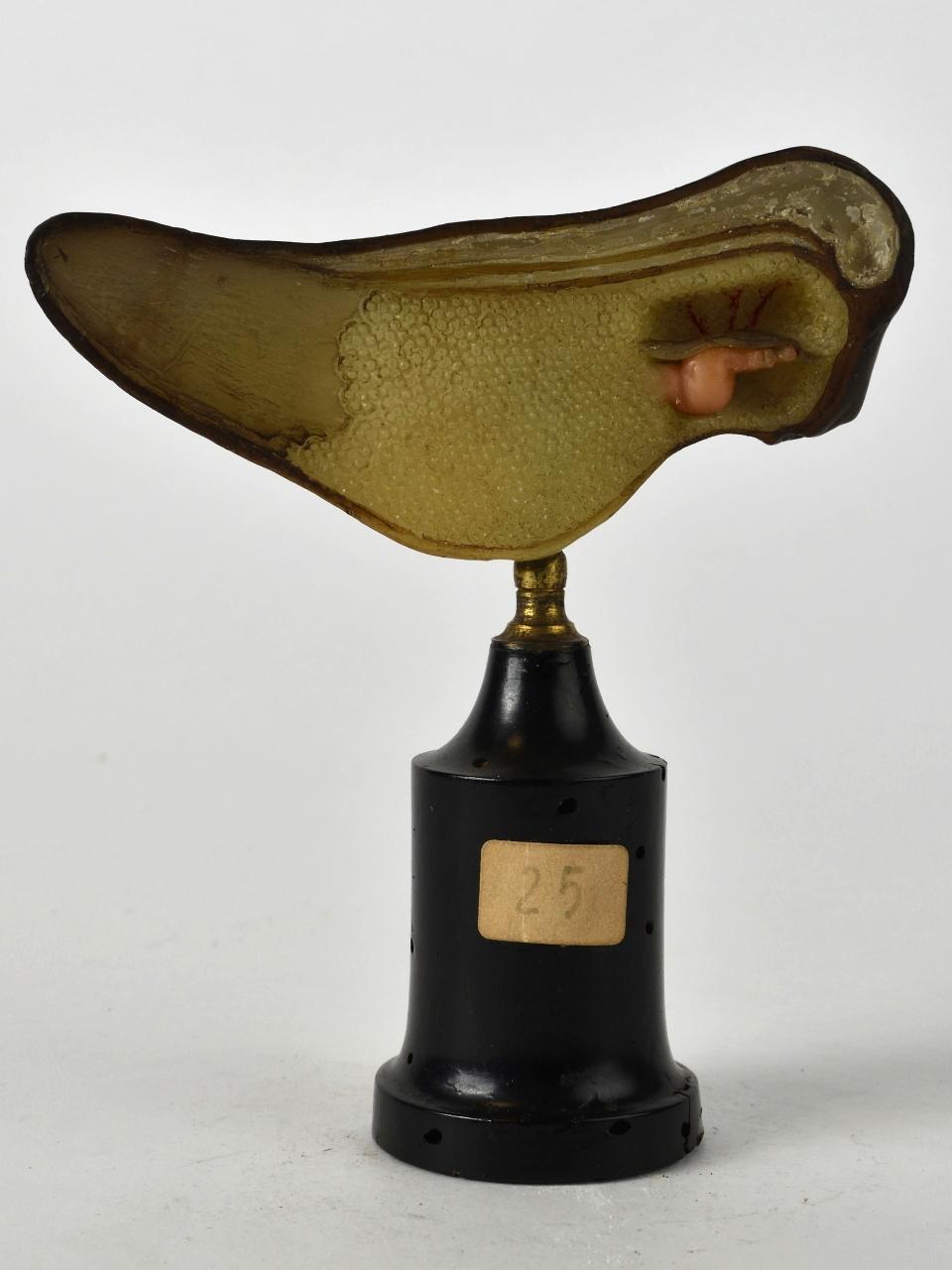 Modello di Laboratorio Ziegler - produzione ceroplastica ottocentesca (sec. XIX)